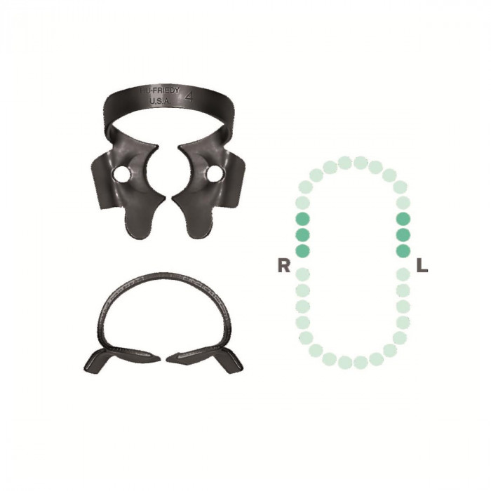 Crampon Molaire du Haut